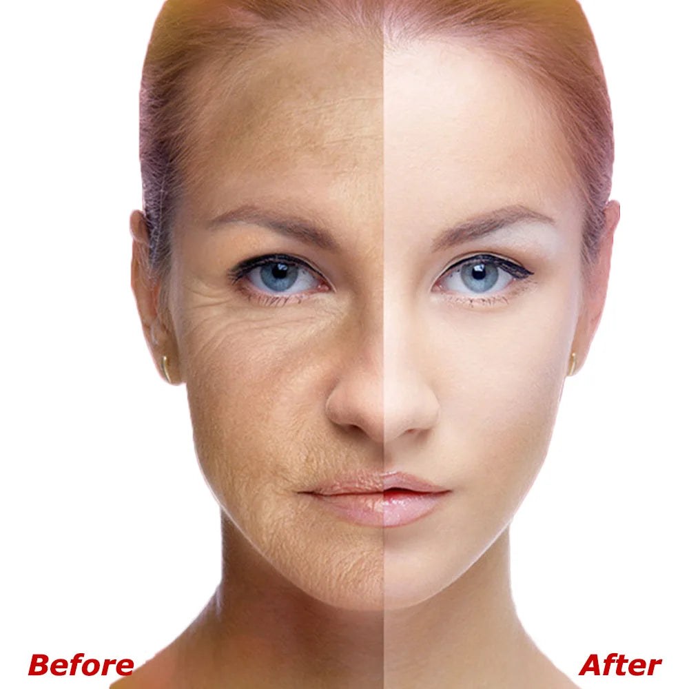 MATLEE 50ml Collagen Peptides Serum - Erase Fine Lines, Nasolabial Folds, Firms Anti-aging for Facial Rejuvenation