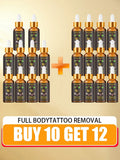 2026 Hot sale For the removal of colored permanent makeup tattoos,pattern tattoo removal