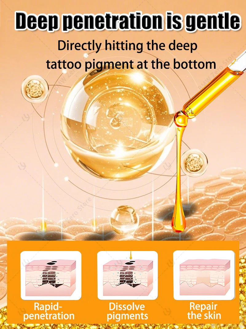 2026 Hot sale For the removal of colored permanent makeup tattoos,pattern tattoo removal