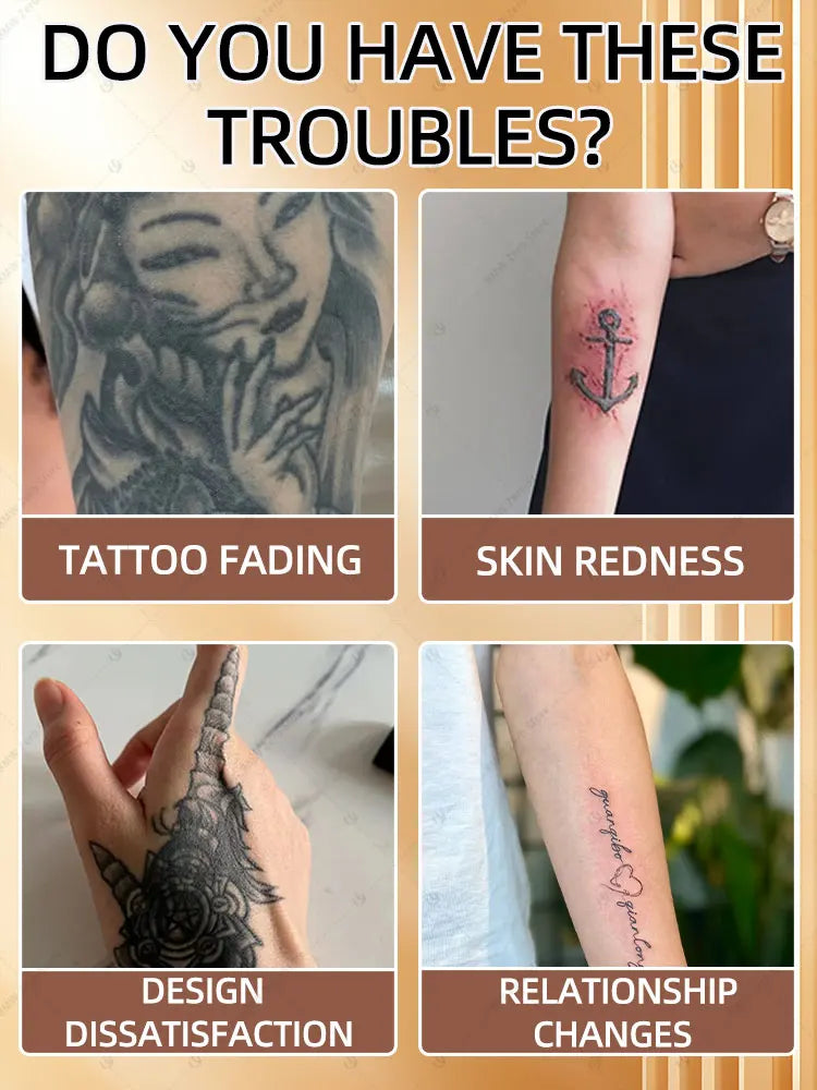 2026 Hot sale For the removal of colored permanent makeup tattoos,pattern tattoo removal