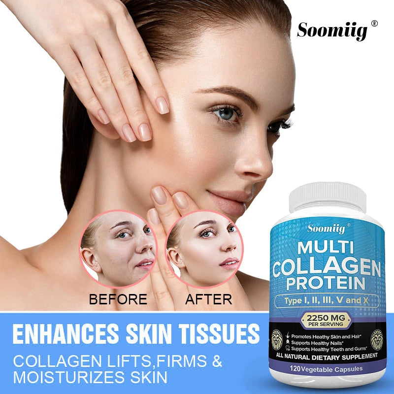 Multi Collagen Capsules with Biotin, Hyaluronic Acid - Type I, II, III, V, X - for Men & Women - Hair, Skin, Nails Beauty