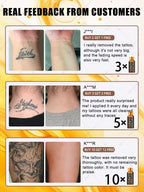 2026 Hot sale For the removal of colored permanent makeup tattoos,pattern tattoo removal