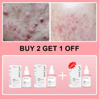 Collagen Peptide Facial Serum Targets Dull Skin Boosts Skin Elasticity Stimulates Skin Renewal Repair Salmon PDRN KOREAN Product